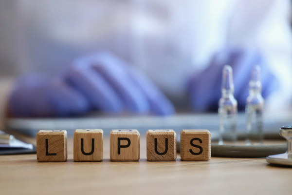 Lupus: Symptomer, årsaker, behandling og hva du bør vite