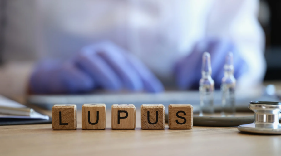 lupus